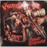 Coronary Reconstruction- EP cover
