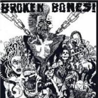 Dem Bones cover